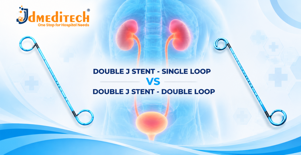 Double J Stent Single Loop vs Double Loop: Key Differences