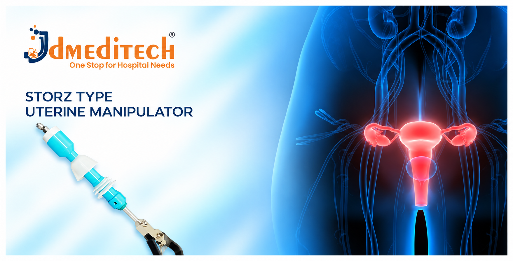 STORZ Type Uterine Manipulator: Uses, Features, Components & Specifications